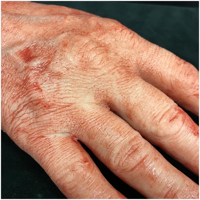 Severed Silicone Male Hand