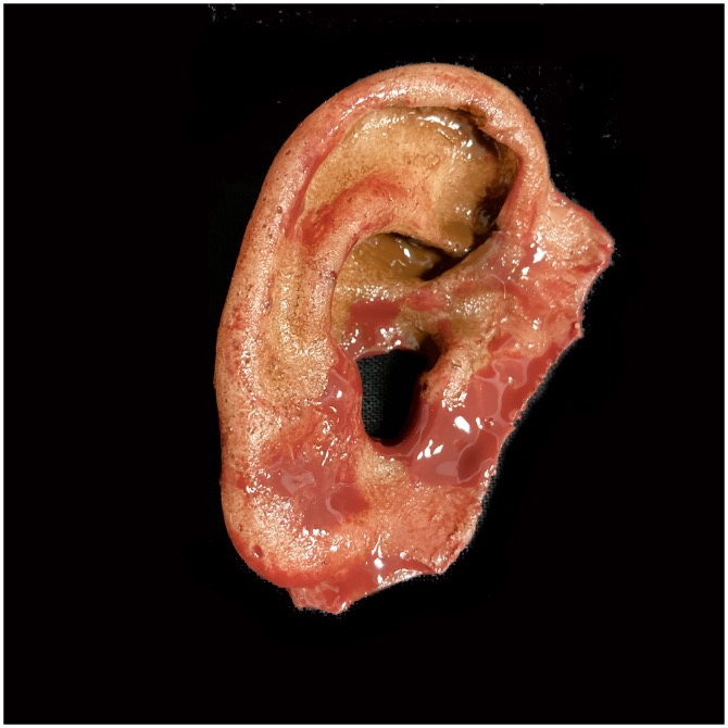 Silicone Severed Ear