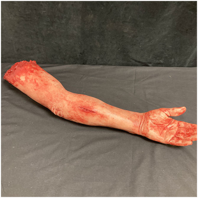 Silicone Severed Full Arm