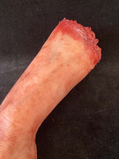 Silicone Male Arm - Cadaver