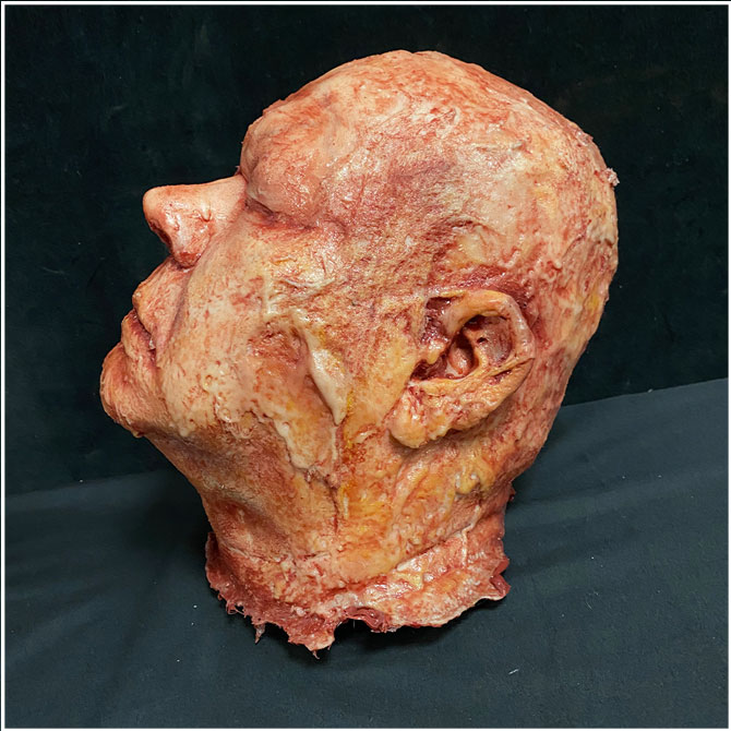 Silicone Severed Head - Abe, Burned