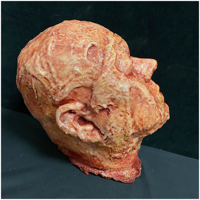 Silicone Severed Head - Abe, Burned