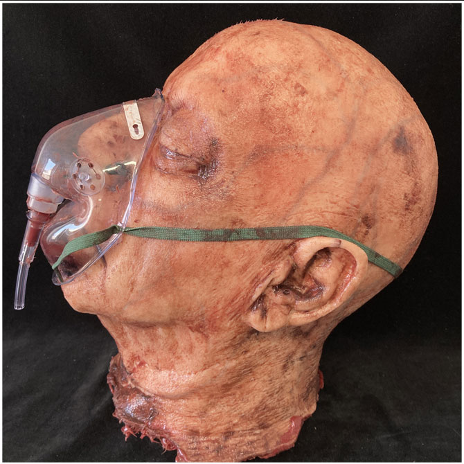 Silicone Severed Head - Clarence, Patient