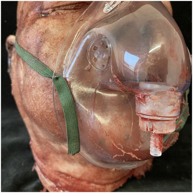 Silicone Severed Head - Abe, Patient