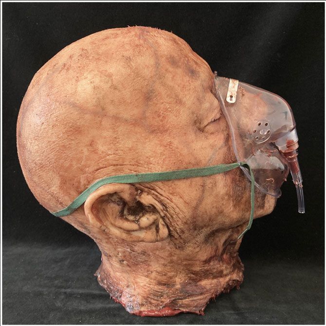 Silicone Severed Head - Clarence, Patient