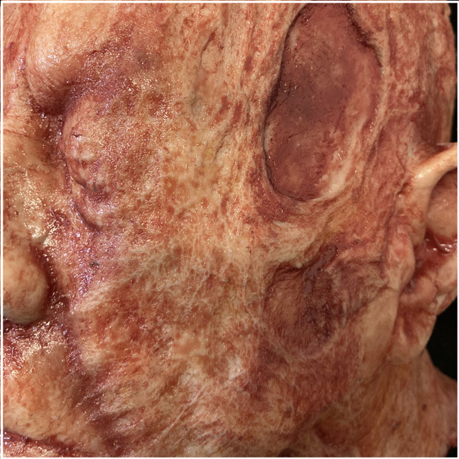 Silicone Severed Head - Clarence, burned