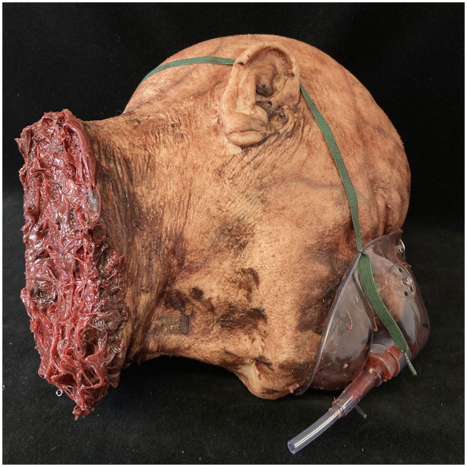 Silicone Severed Head - Clarence, Patient