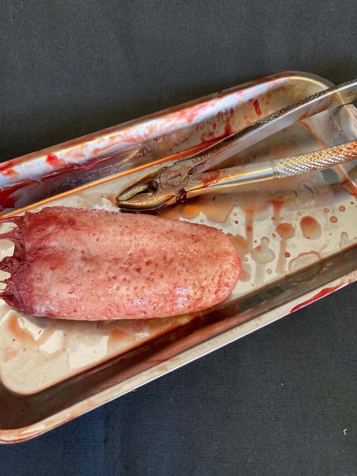 Surgical Tray with Silicone Severed Tongue