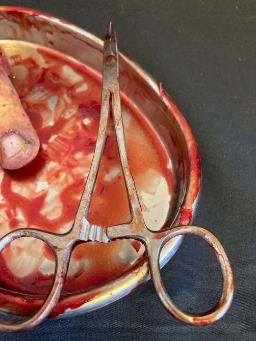 Surgical Tray with Silicone Severed Finger