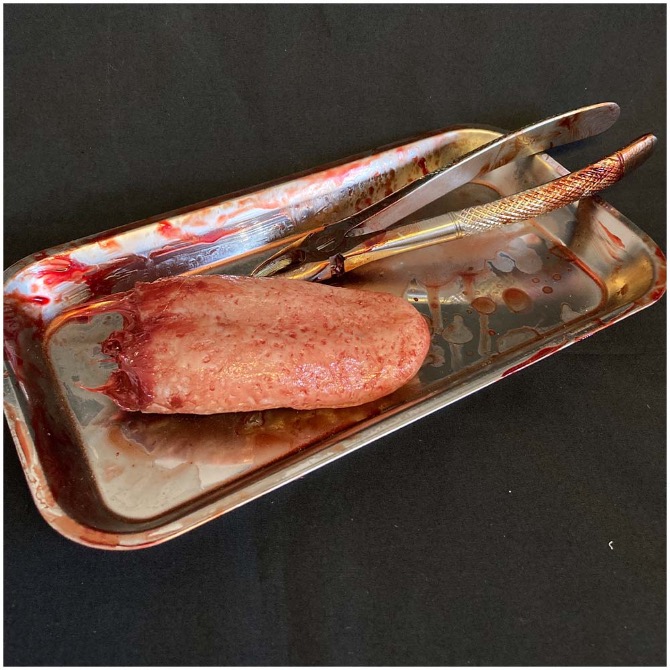 Surgical Tray with Silicone Severed Tongue