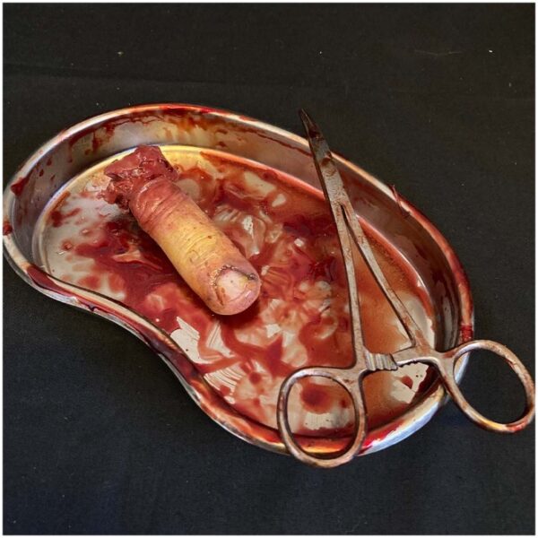 Surgical Tray with Silicone Severed Finger