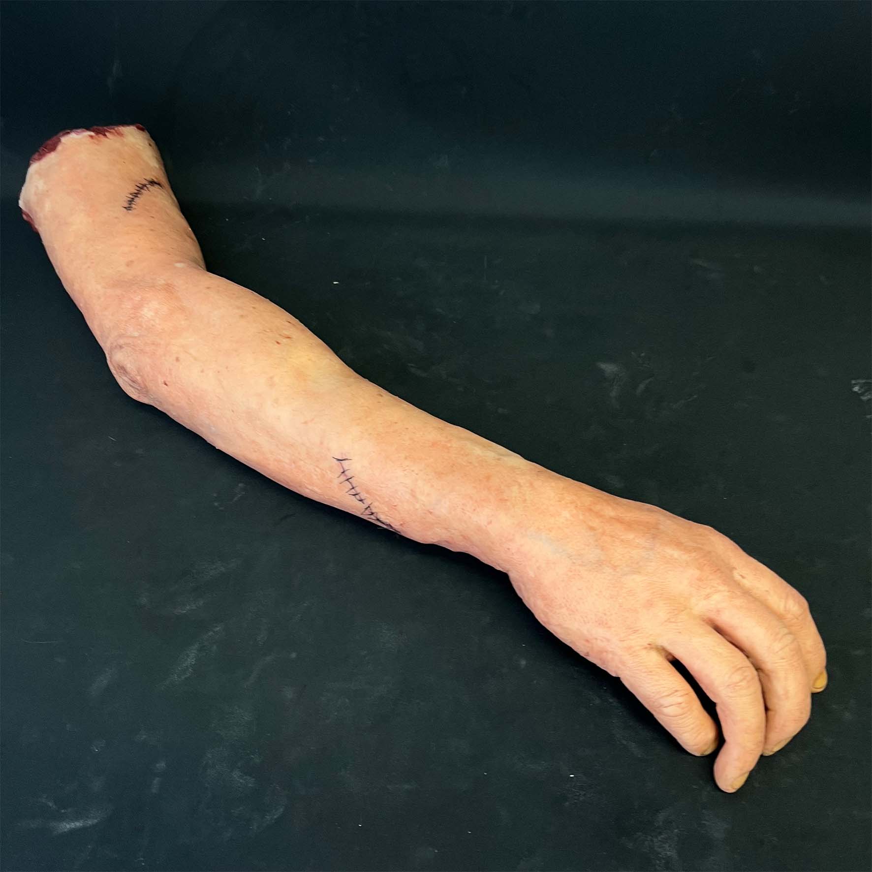 Silicone Severed Full Arm With Stitches - Male