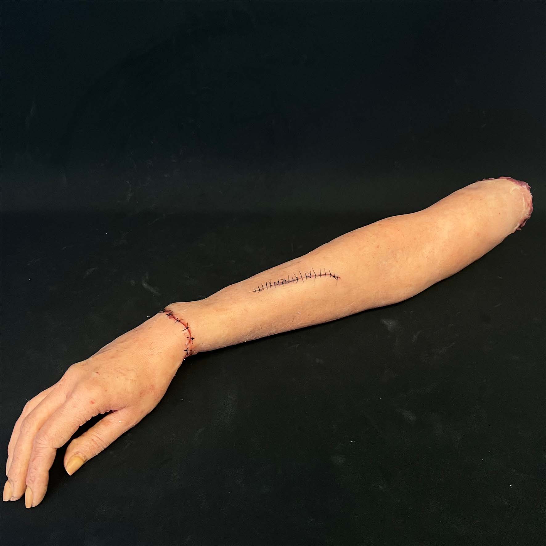 Silicone Severed Full Arm With Stitches - Female