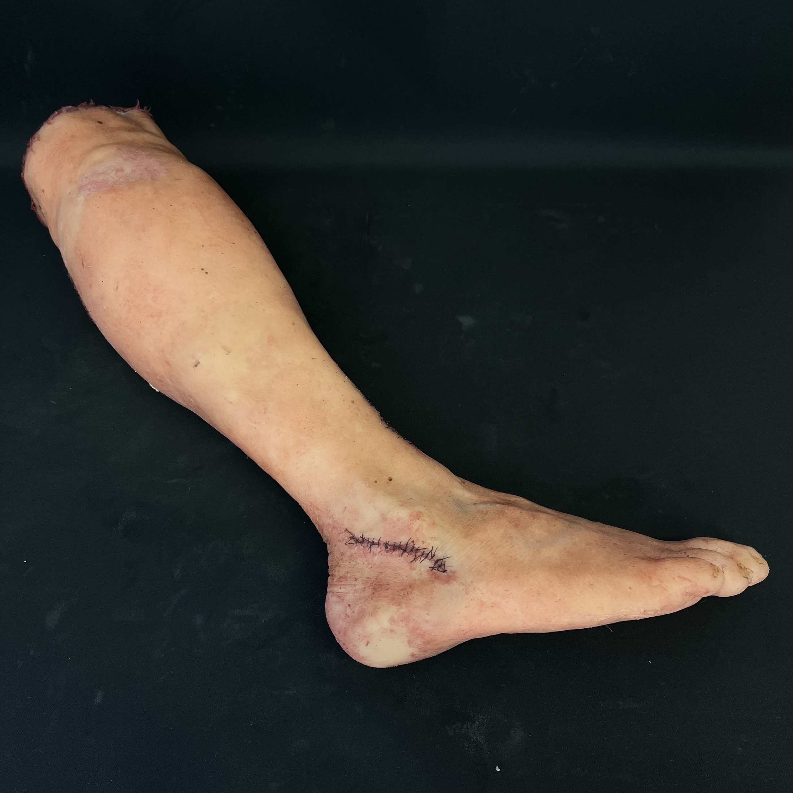 Silicone Severed Leg With Stitches - Male