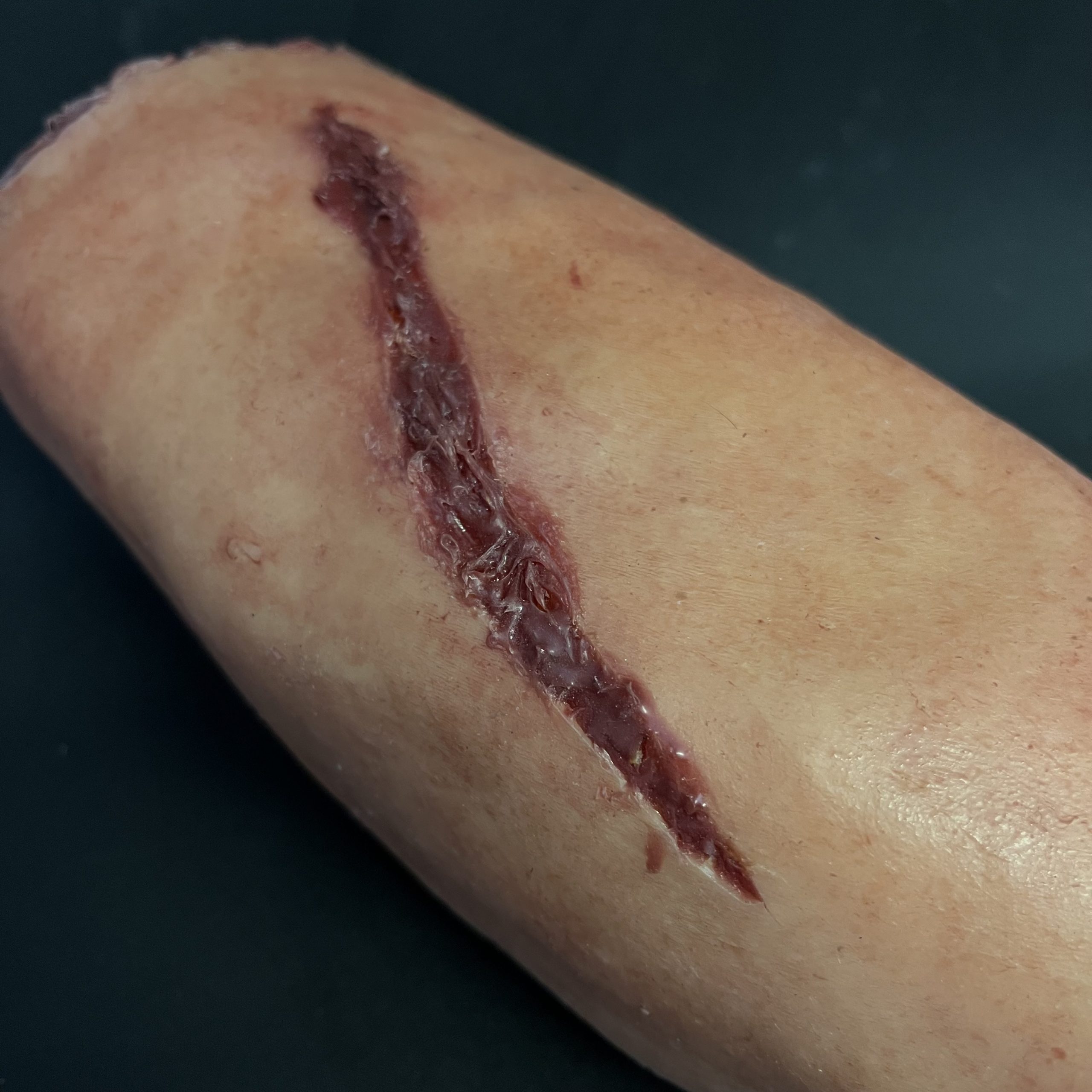 Silicone Severed Leg With Wounds - Female