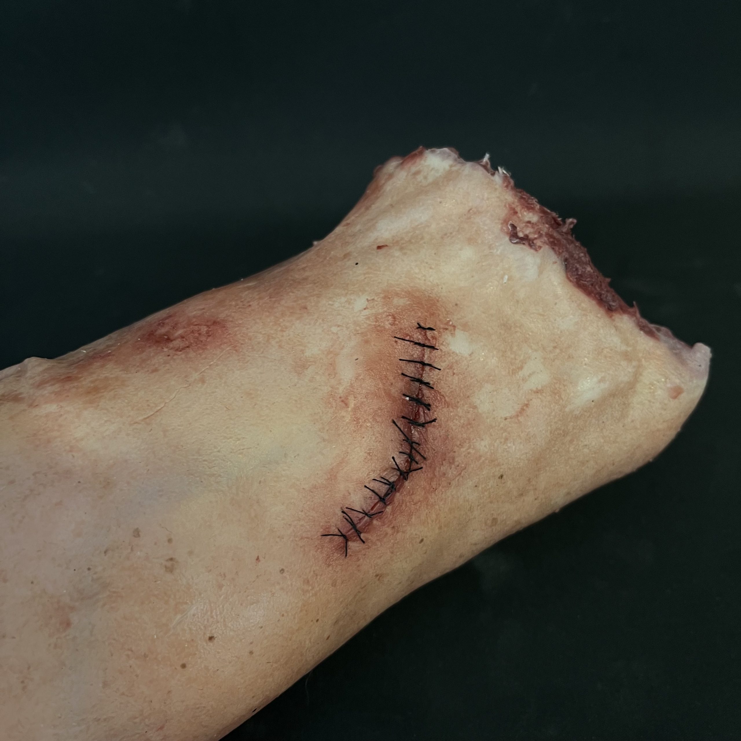 Silicone Severed Leg With Stitches - Female