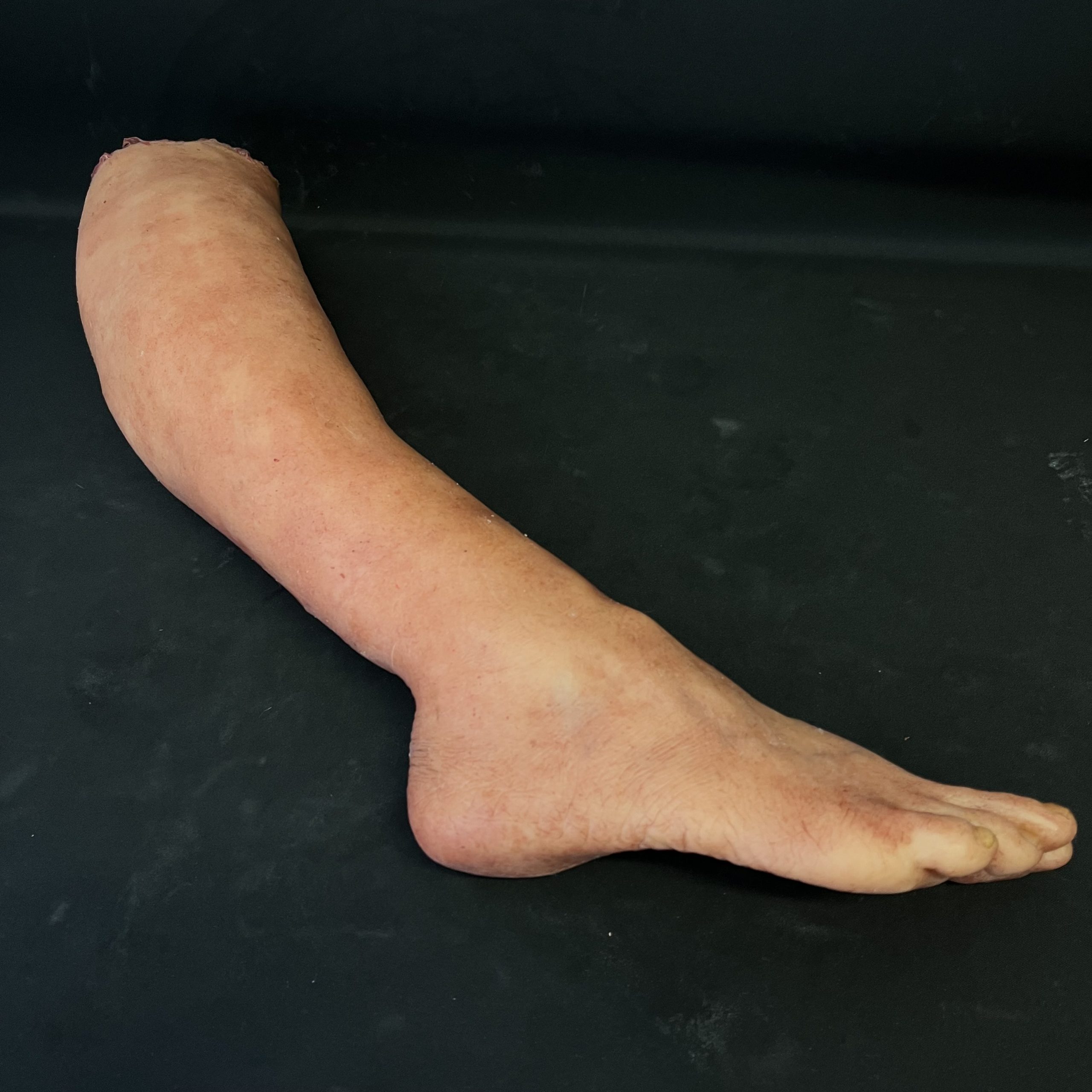 Silicone Severed Leg - Female