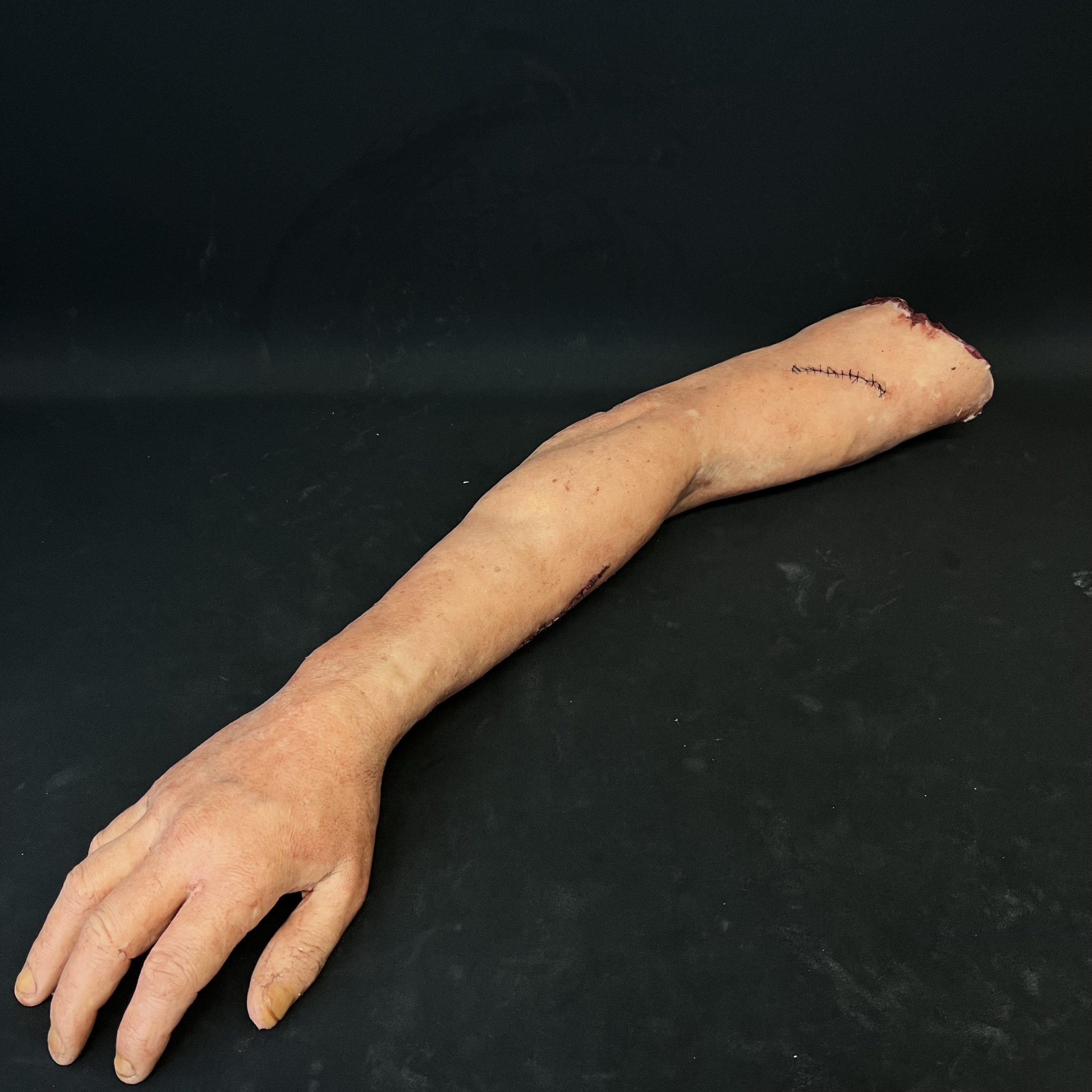 Silicone Severed Full Arm With Stitches - Male