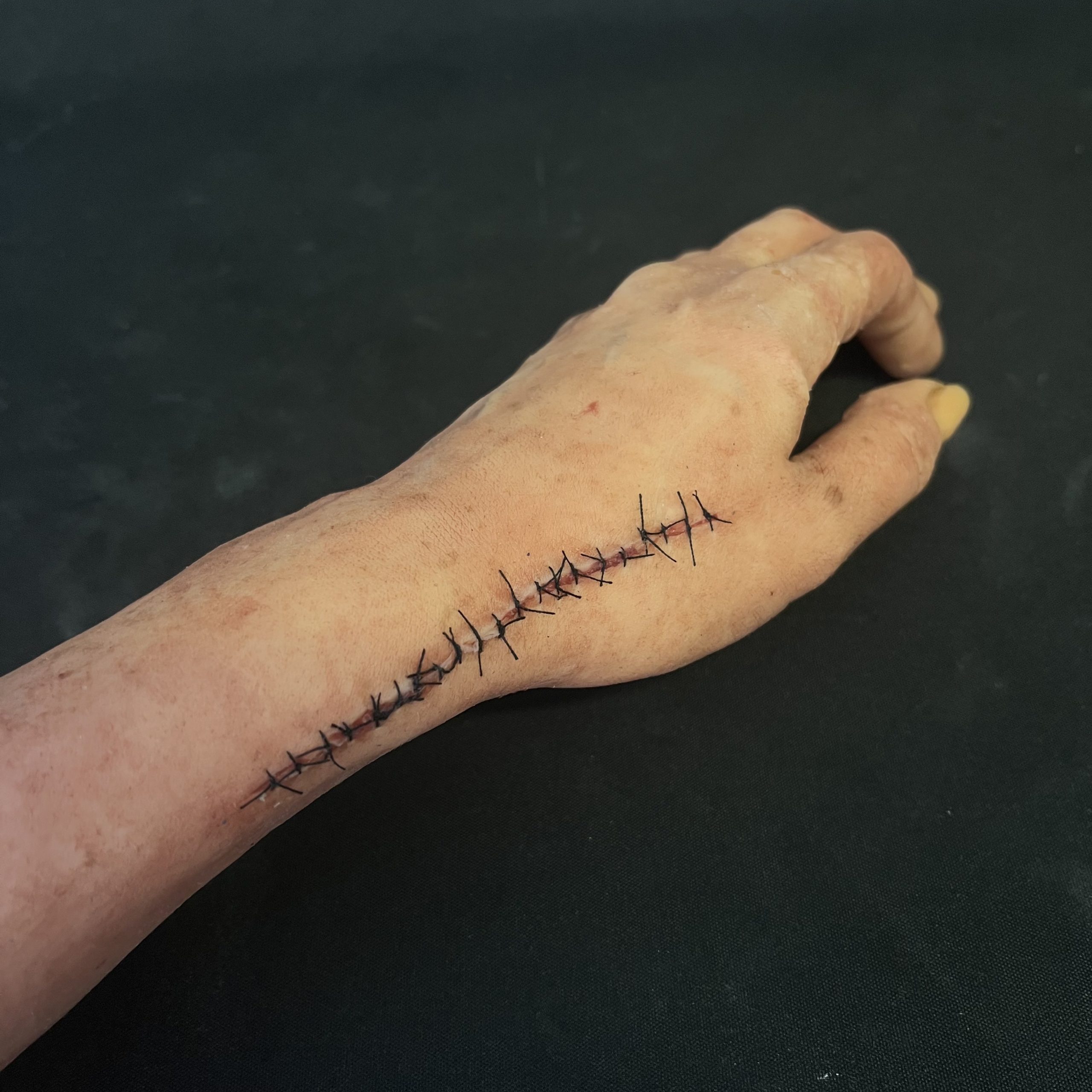 Silicone Severed Full Arm With Stitches - Female