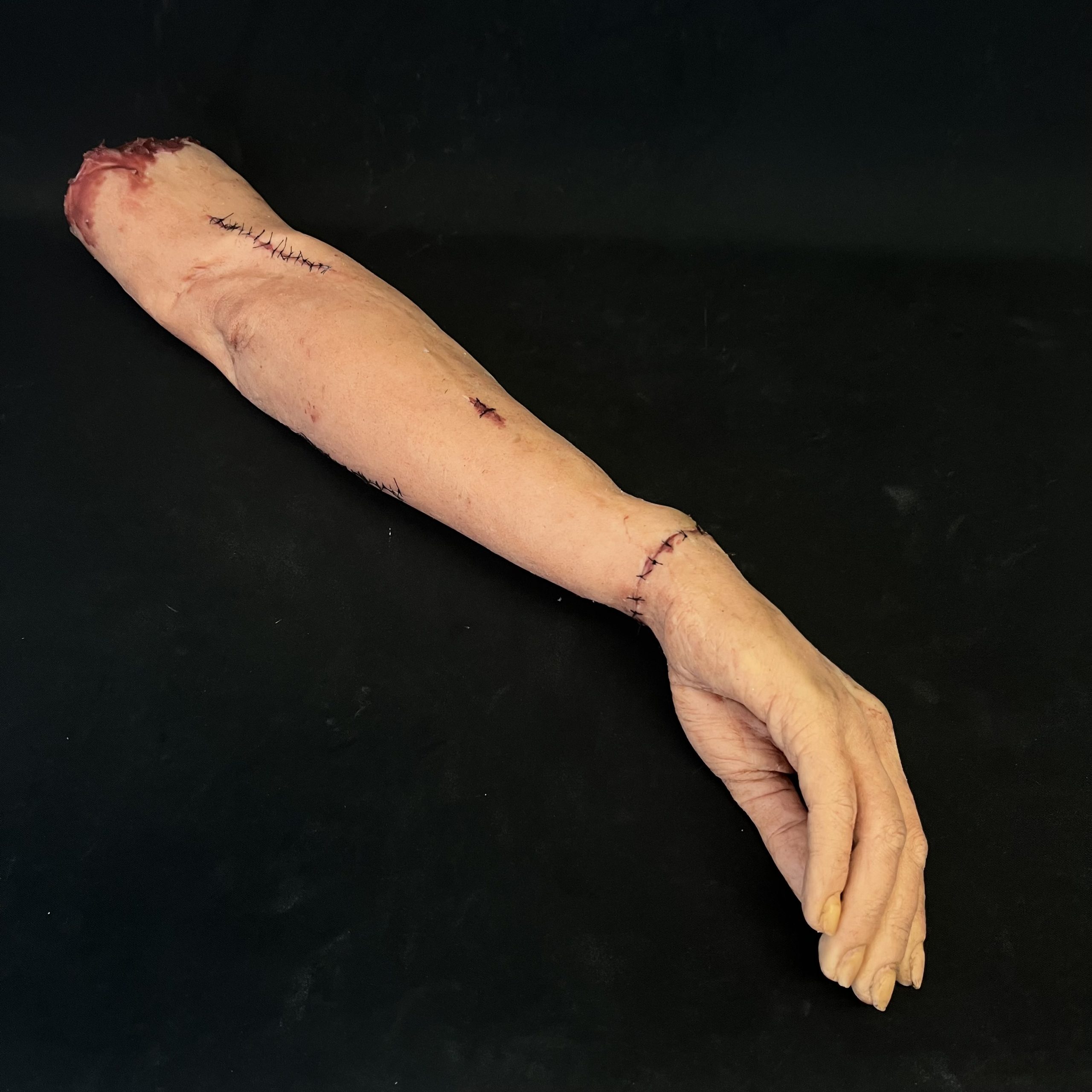 Silicone Severed Full Arm With Stitches - Female