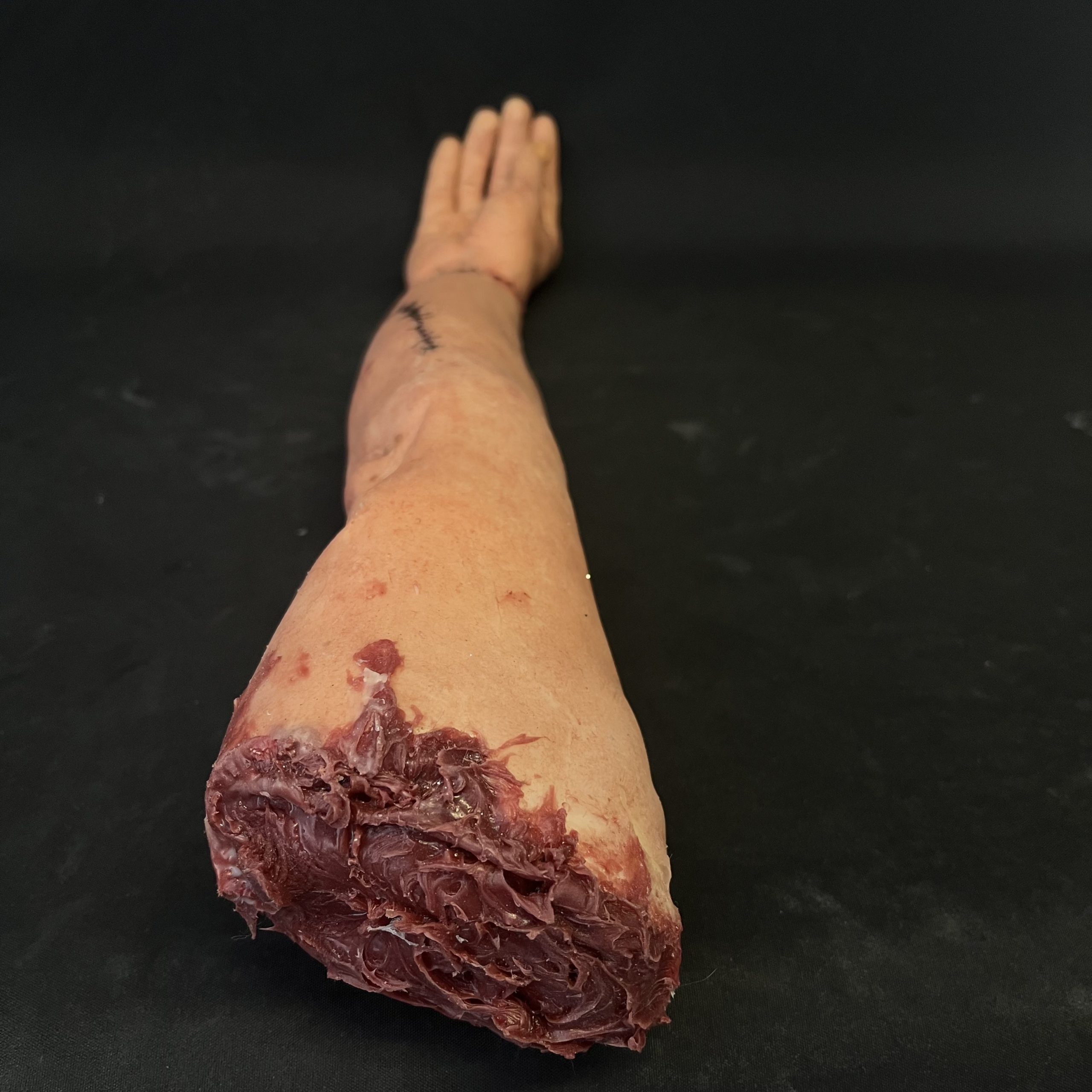 Silicone Severed Full Arm With Stitches - Female