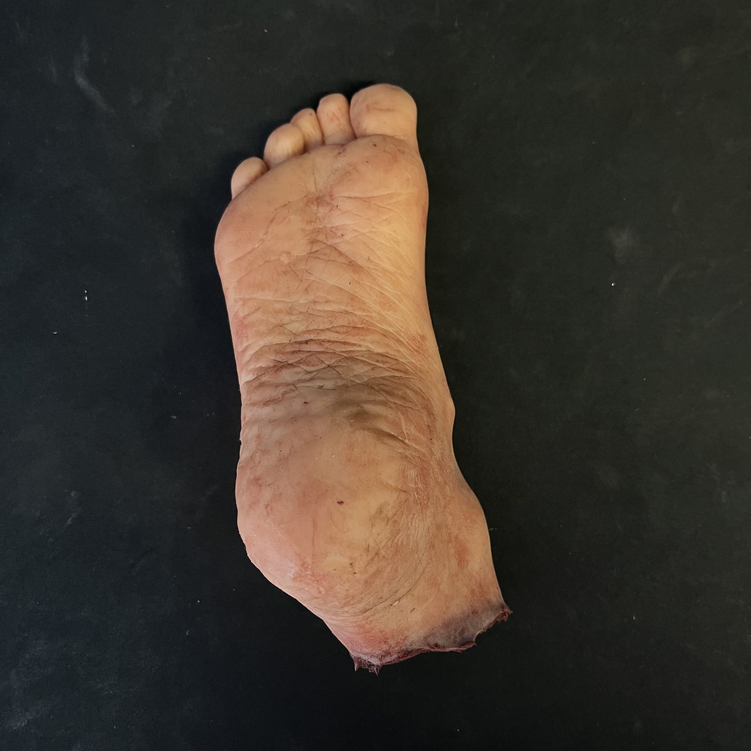 Silicone Severed Foot With Wounds - Female