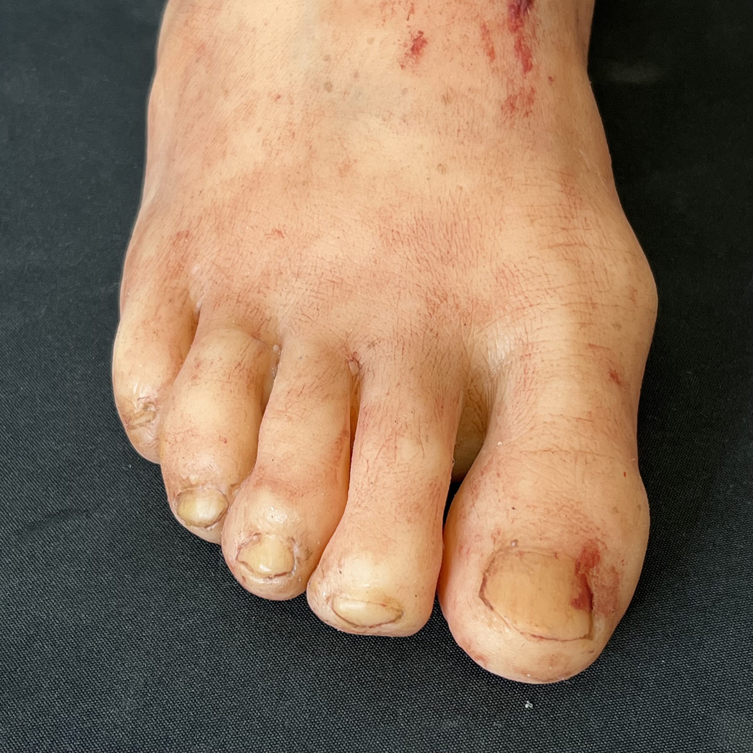 Silicone Severed Foot With Wounds - Male