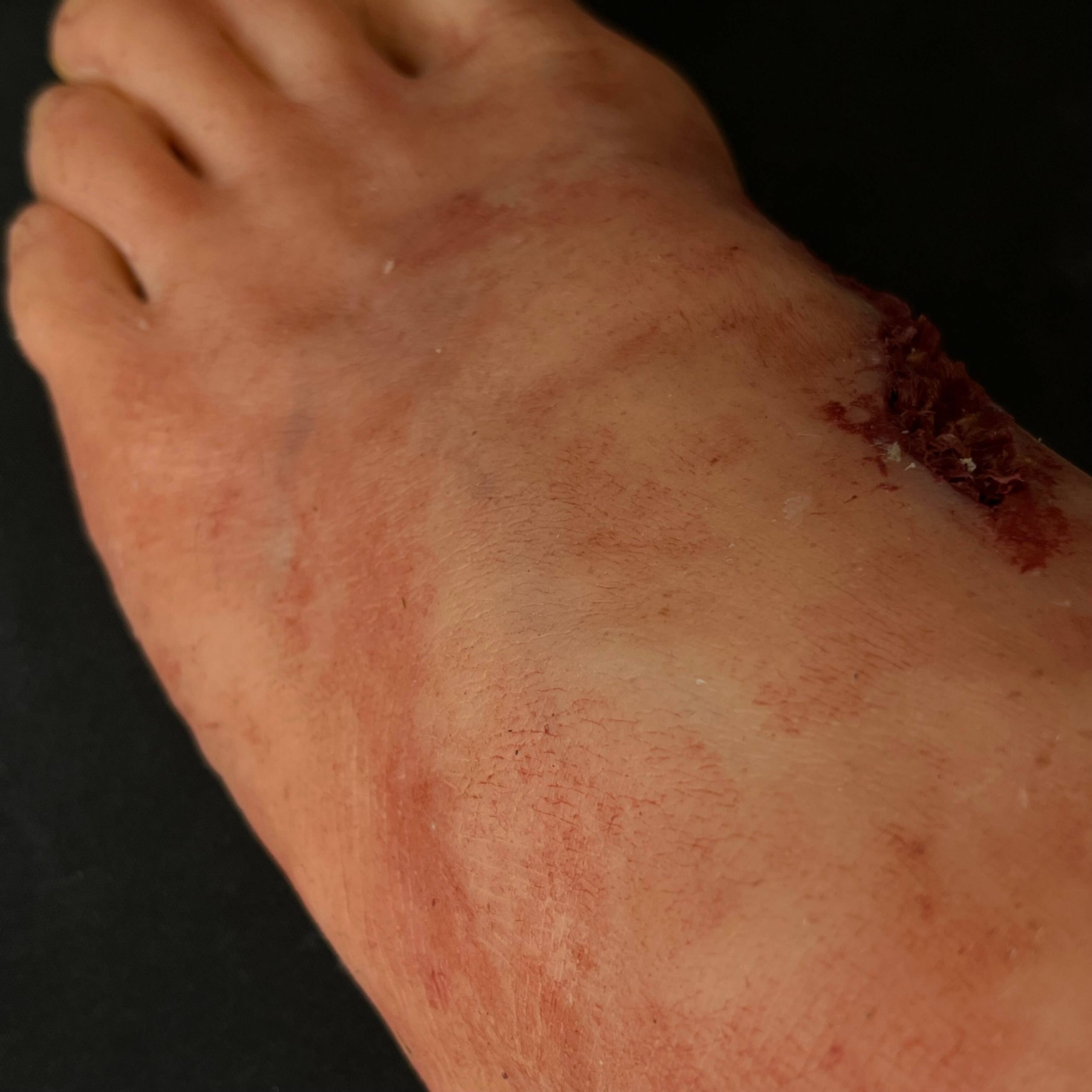 Silicone Severed Foot With Wounds - Male