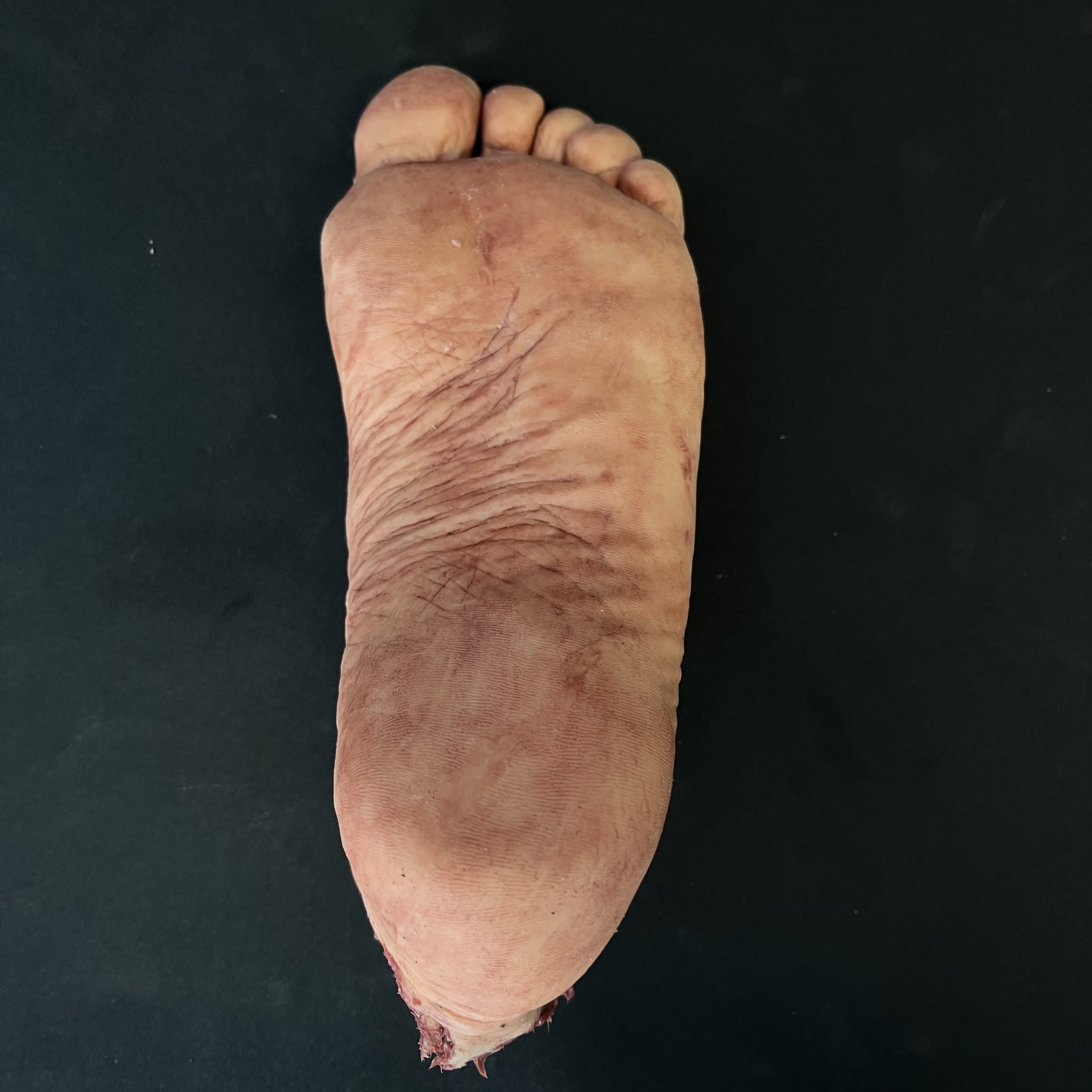 Silicone Severed Foot - Male