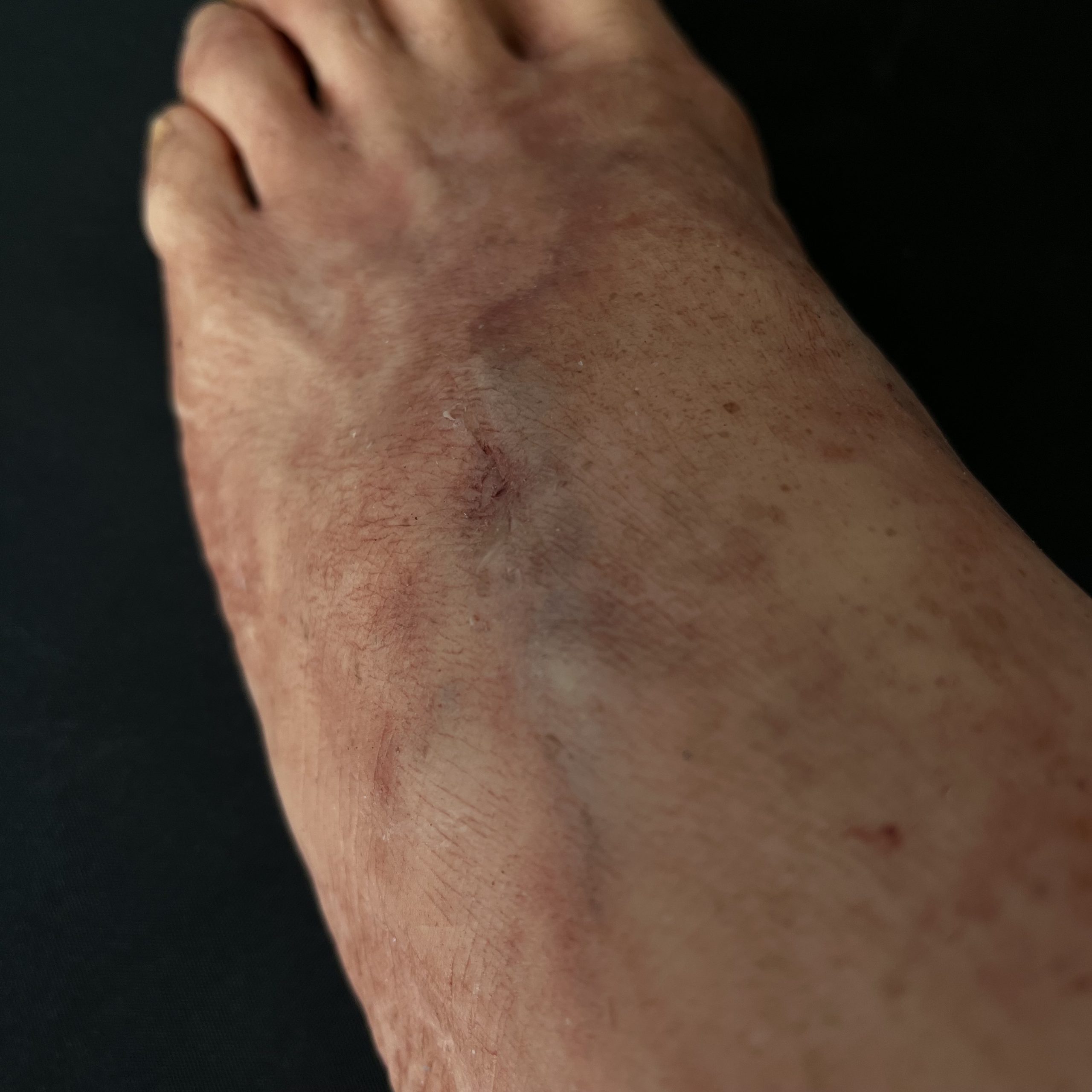 Silicone Severed Foot - Male