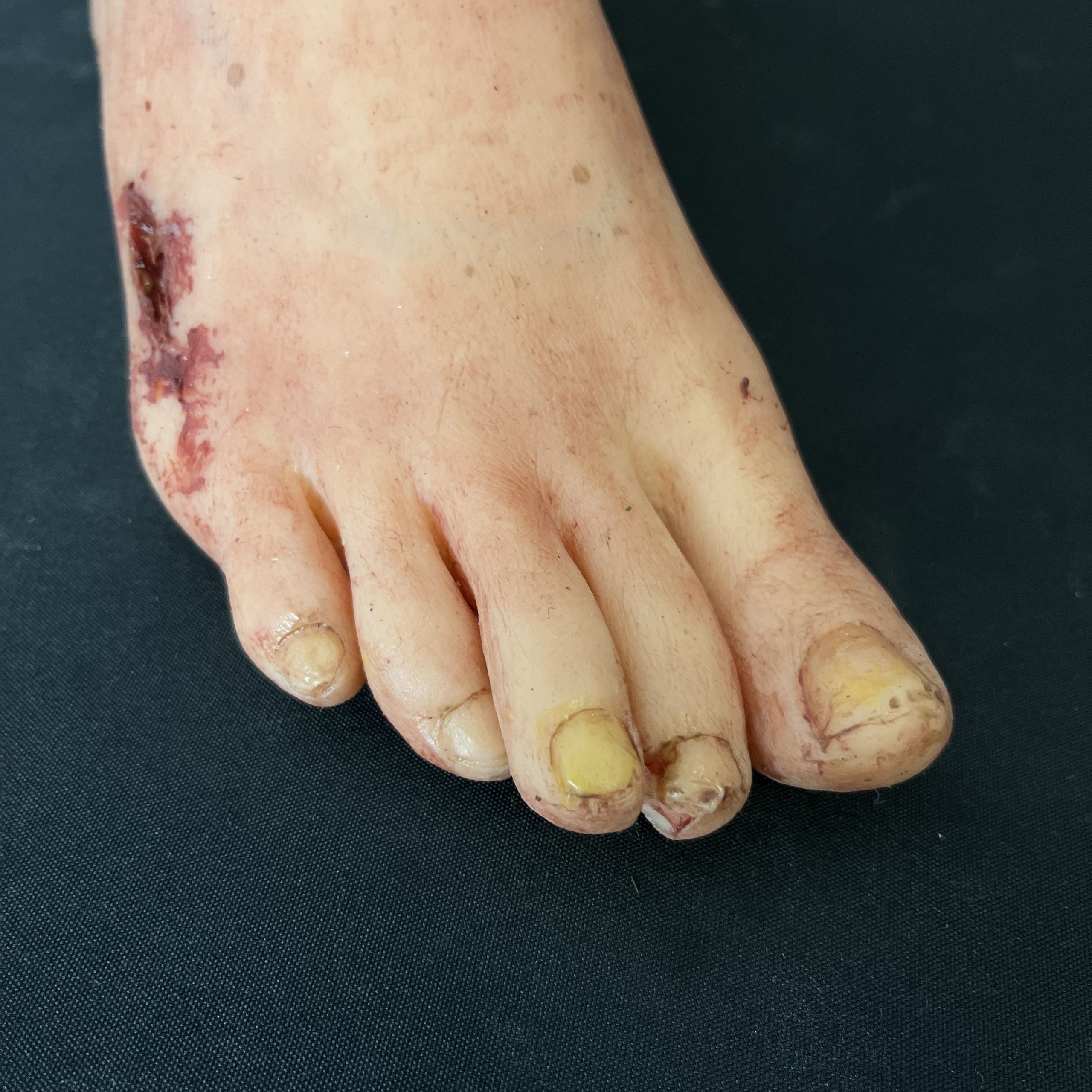 Silicone Severed Foot With Wounds - Female