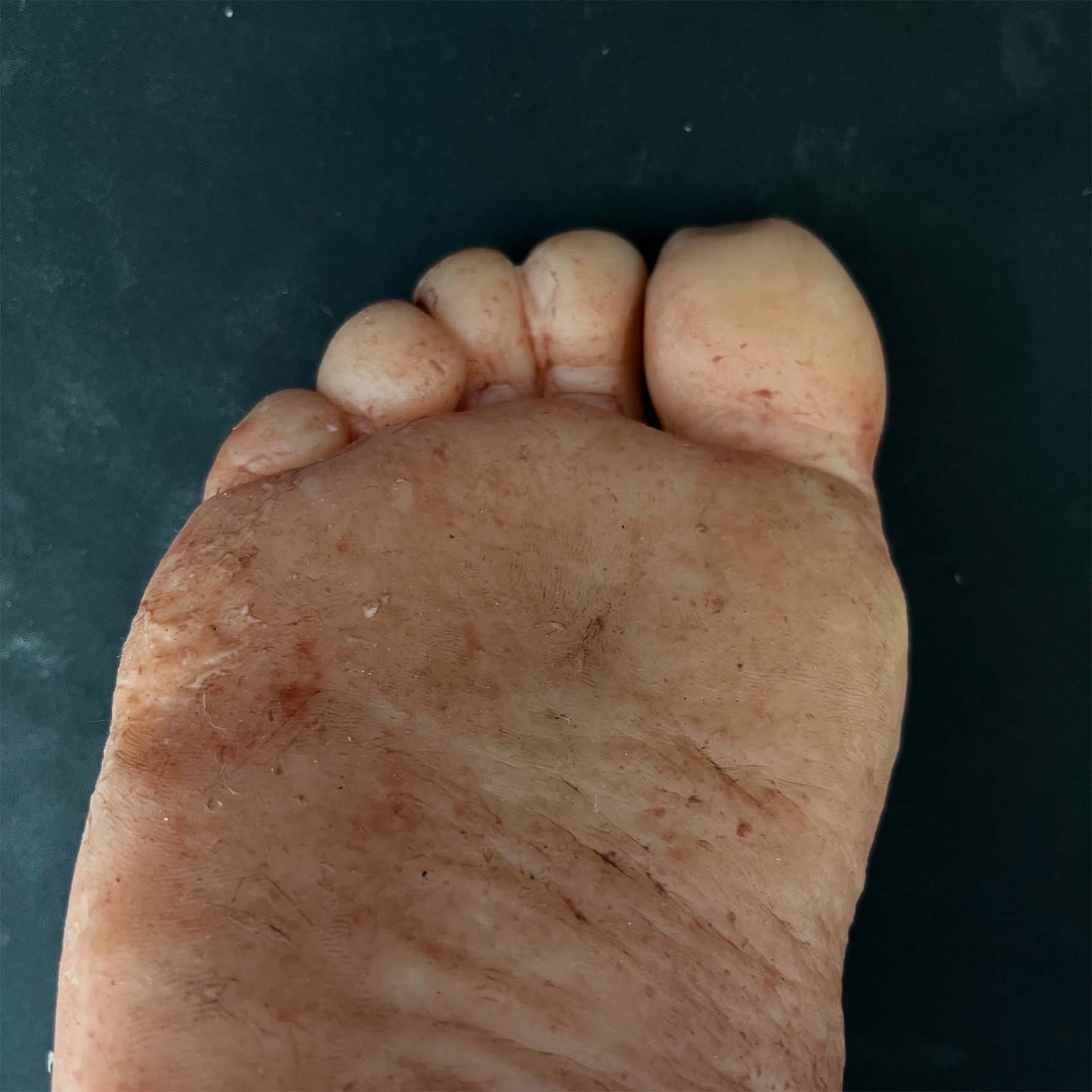 Silicone Severed Leg With Stitches - Female