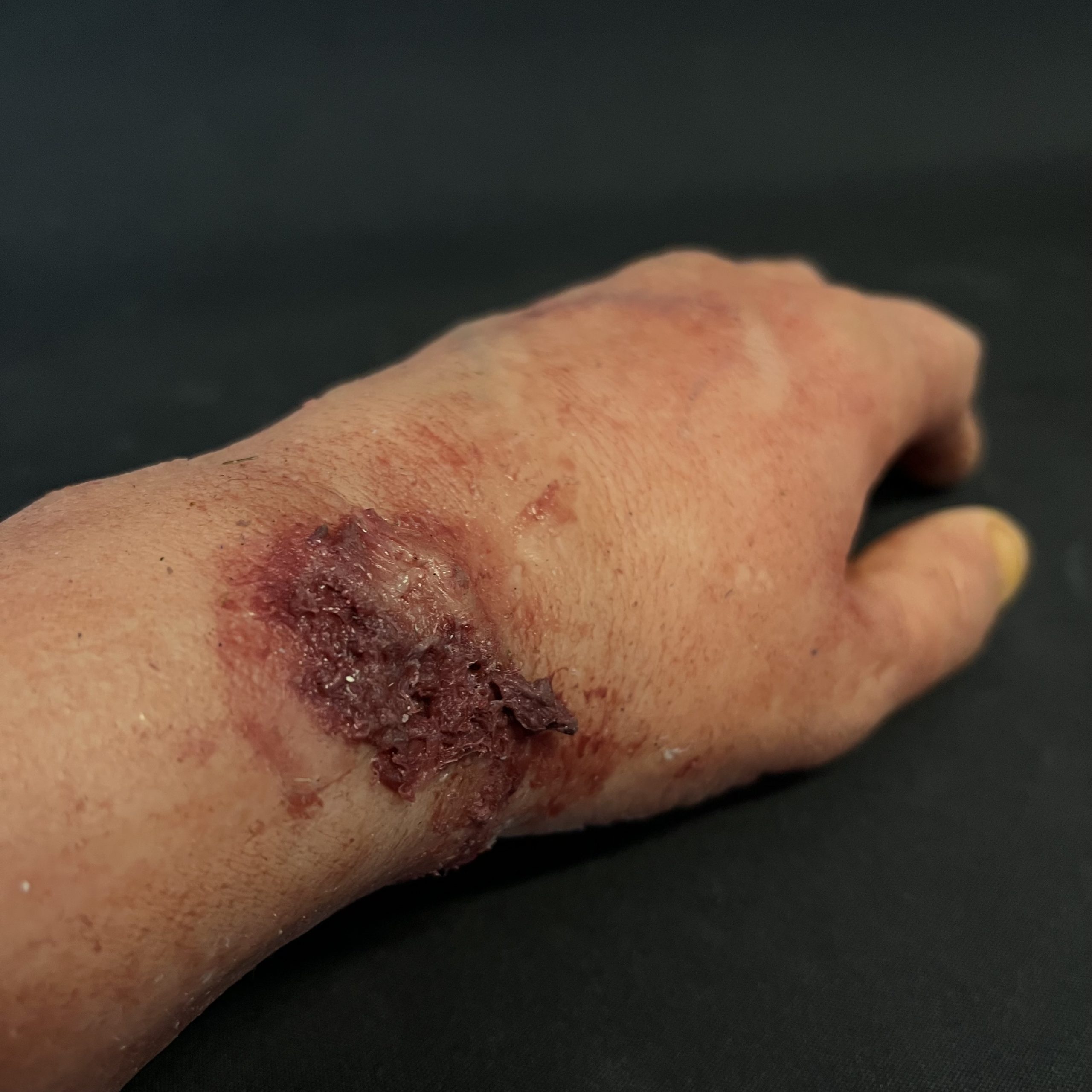 Silicone Severed Forearm With Wrist Wound - Male