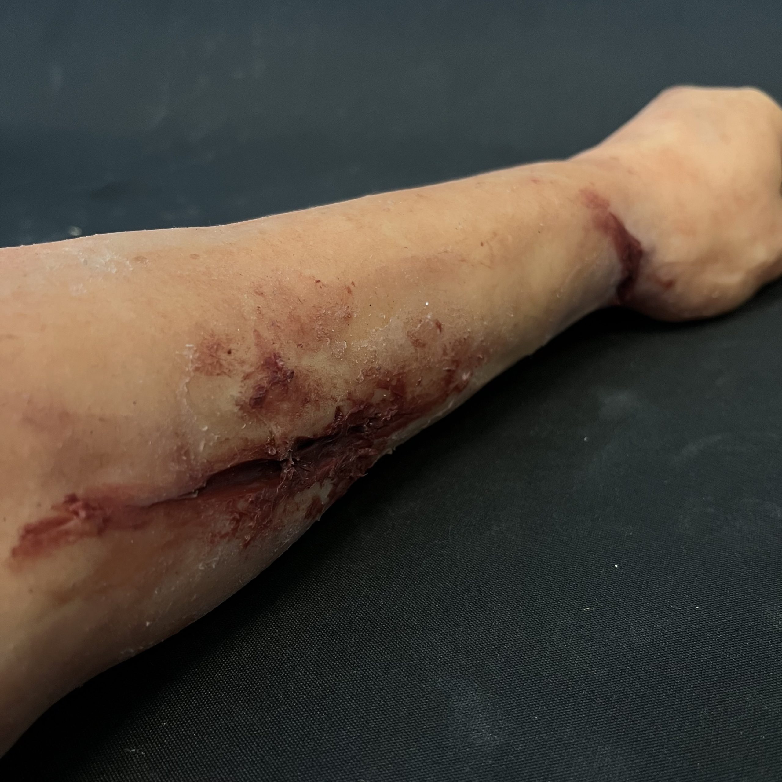 Silicone Severed Arm With Wounds - Female