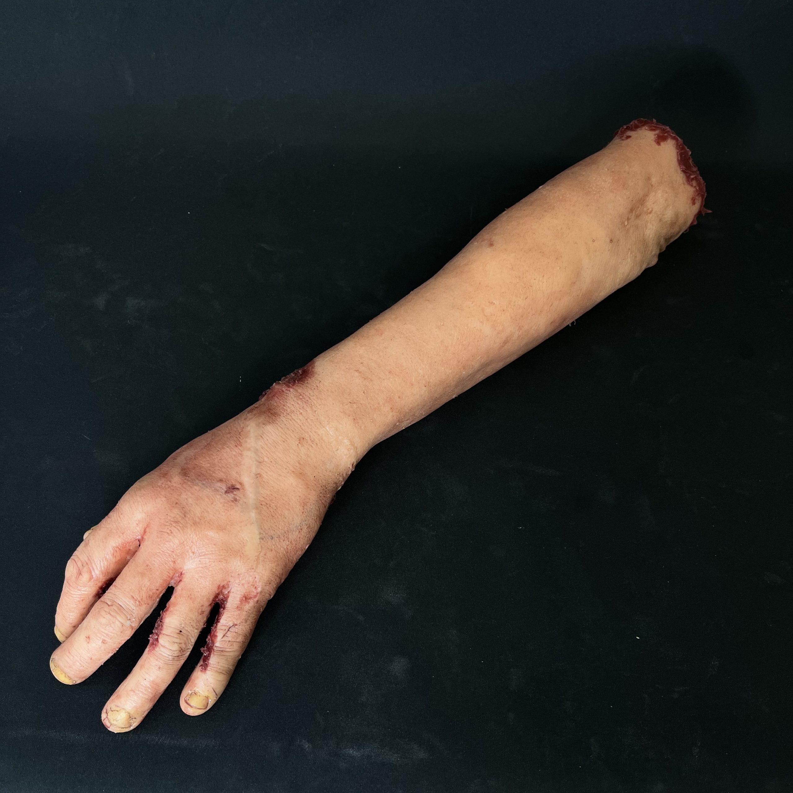 Silicone Severed Forearm With Wrist Wound - Male