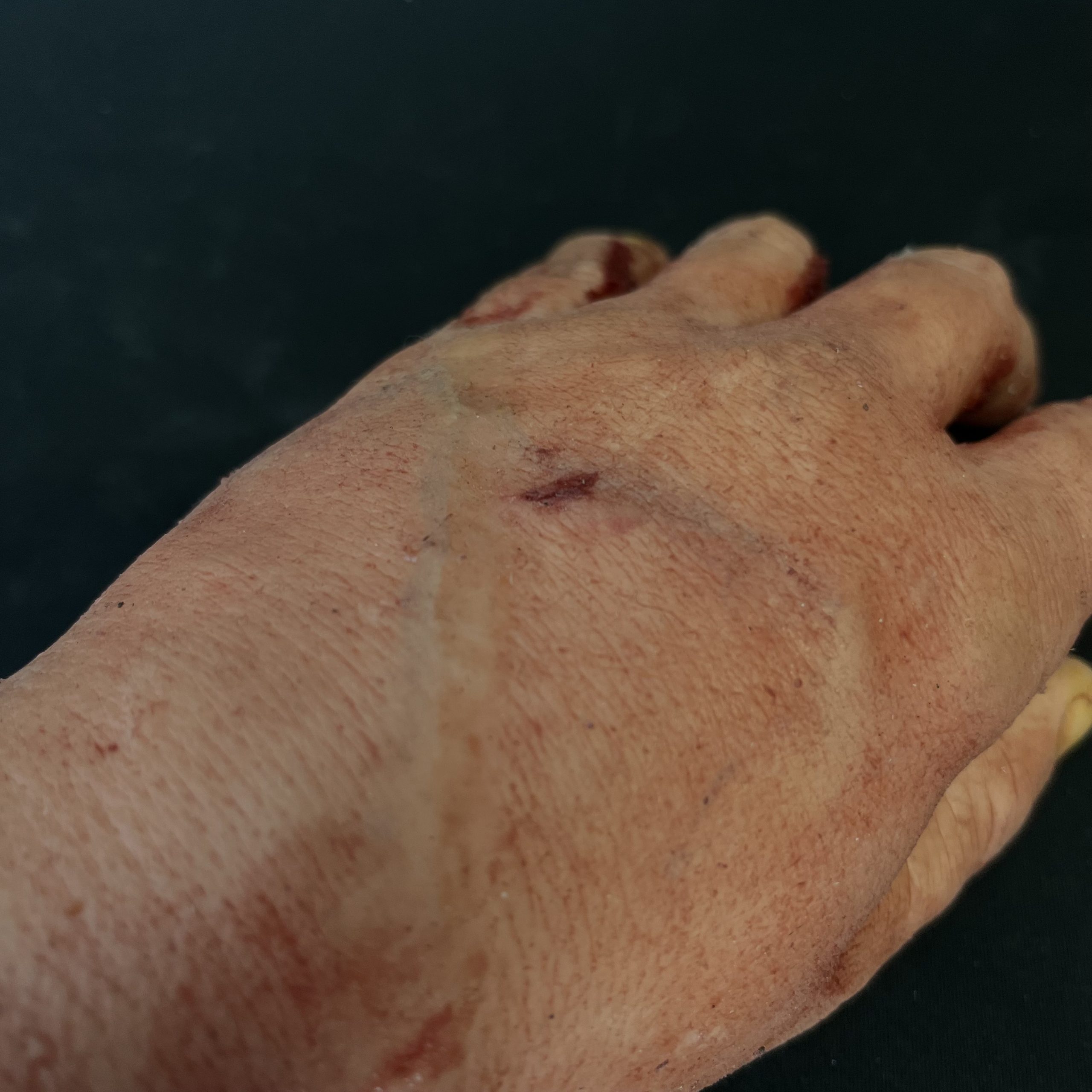 Silicone Severed Forearm With Wrist Wound - Male