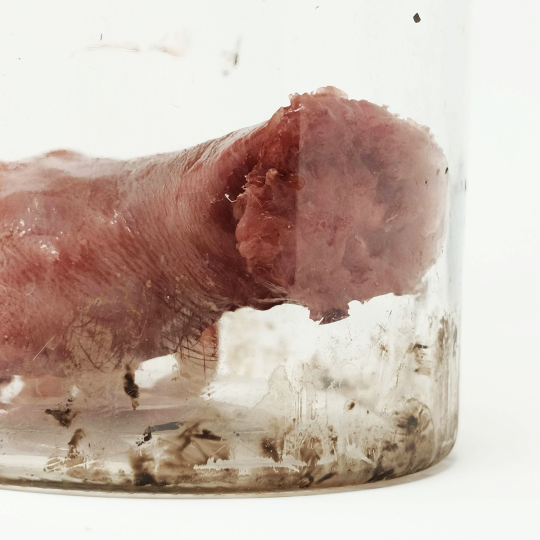 Specimen Jar with Hand