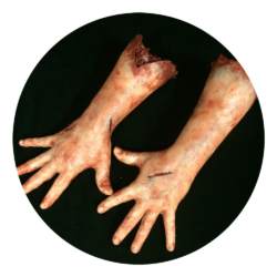 Hands & Arms